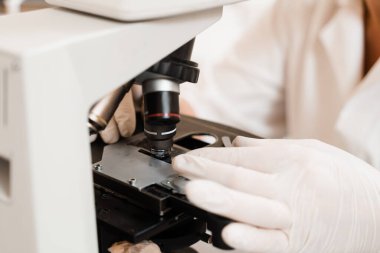Mikroskop laboratuarını kullanarak kan analizi. Tıbbi klinikte hematolojik ve biyokimyasal kan testleri için tıbbi ekipmanlar