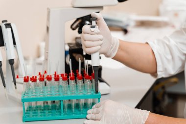 Mikroskop laboratuarını kullanarak kan analizi. Tıbbi klinikte hematolojik ve biyokimyasal kan testleri için tıbbi ekipmanlar