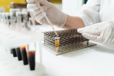 Kan plazmasının yakın plan analizi. Laboratuvar asistanı elinde damardan alınan kanla test tüpünü tutuyor ve bakıyor. Laboratuvarda kan testi yapıldı.