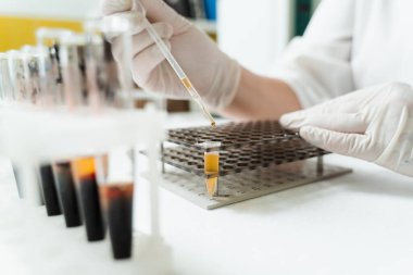 Kan plazmasının yakın plan analizi. Laboratuvar asistanı elinde damardan alınan kanla test tüpünü tutuyor ve bakıyor. Laboratuvarda kan testi yapıldı.