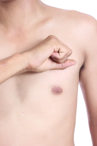 Mannelijke torso, hartaanval — Stockfoto