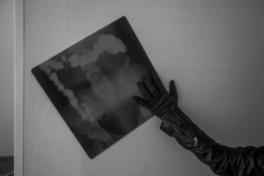 Terk edilmiş bir hastanede akciğerlerin röntgeni. Korkunç bir hastalık. İnsan eli. Siyah beyaz fotoğraf.