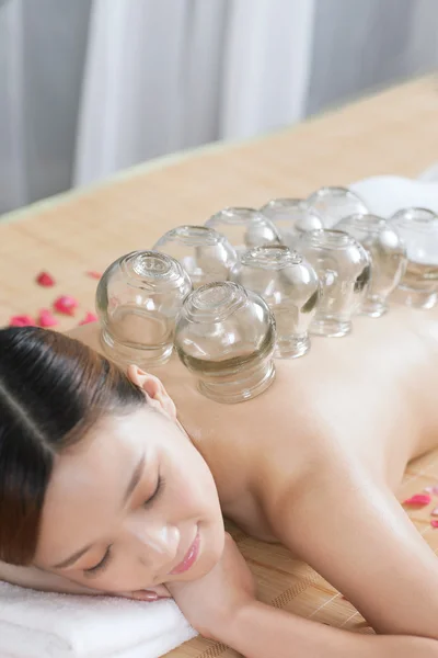 Een chinese geneeskunde cupping — Stockfoto