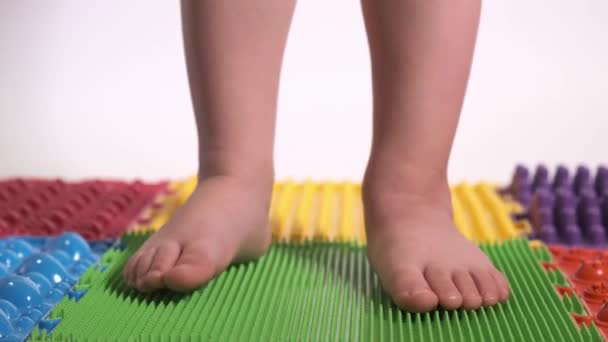 Gyermeklábak közelkép, valgus láb pozícionálás. — Stock videók