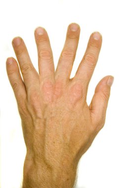 altı parmaklı adam palm