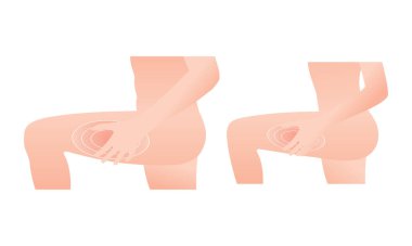 Kalça kasları ve bel kasları ağrıyan insanlar. Sağlık hizmeti konsepti. Kas zorlaması. vektör çizimi izole edildi