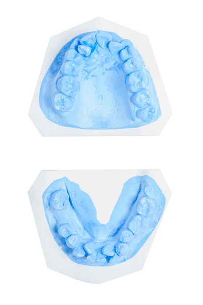 격리 된 흰 배경에 이빨 moldel — 스톡 사진