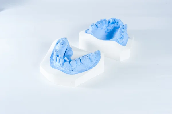 Teeth moldel on isolated white background — Stock Photo, Image