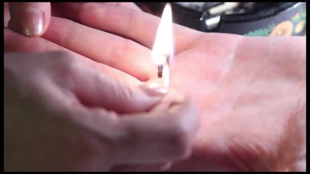 Moxa wird auf eine Hand gelegt und mit Streichholz abgefeuert. Rauch und Rauch aus Moxa — Stockvideo