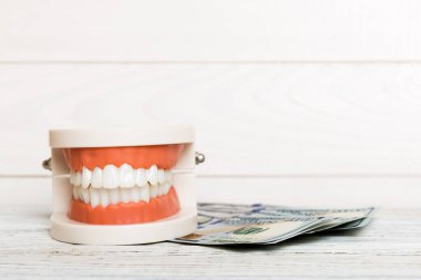 Beyaz dişli ve dolar banknotlu bir insan çenesinin yakın modeli. Diş hekiminin kavramsal fotoğrafı. Protez dişçilik. Kopya alanı ile sahte teet üst görünümü.