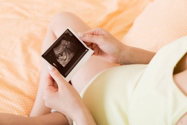 Hamile kadın yatakta oturuyor ve bebeğinin ultrason taramasına bakıyor. Hamile bir kadın ultrason raporunu ve doğmamış bebeğini gösterir..
