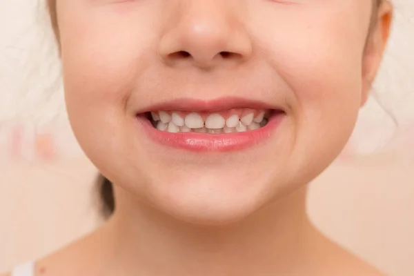 Ein Kleines Mädchen Zeigt Ihre Zähne Großaufnahme Von Kindermund lizenzfreie Stockfotos