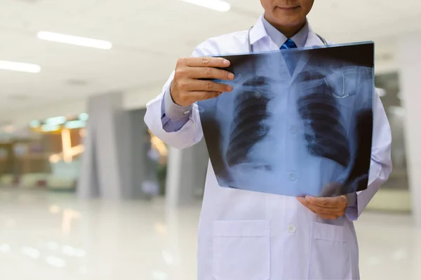 Doctor looking chest x-ray film in hospital.
