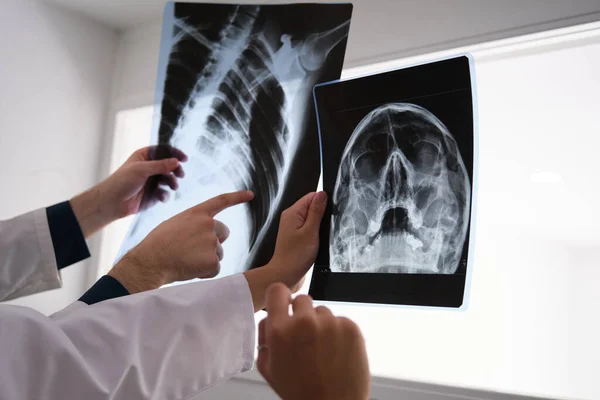 Médicos irreconocibles examinando un cráneo y una radiografía de costillas. —  Fotos de Stock