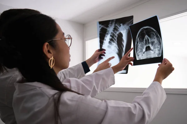 Dos doctores examinando un cráneo y una radiografía de costillas. —  Fotos de Stock