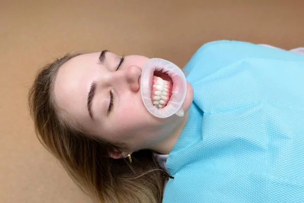 Ασθενής Ξαπλώνει Στην Καρέκλα Του Οδοντιάτρου Στόμα Ανοιχτό Και Μάτια — Φωτογραφία Αρχείου