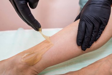 Güzellik salonunda şekerleme işlemi. Kozmetik uzmanı kadın epilasyon ya da tüy dökme işleminden önce genç kızın bacağına balmumu ya da şeker sürüyor.. 