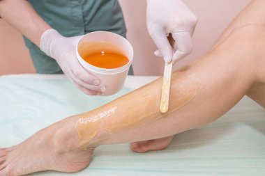 Glikoz macunu kullanılarak bacaklarda epilasyon işlemi. Spa merkezinde kozmetik şeker saçı kesimi.