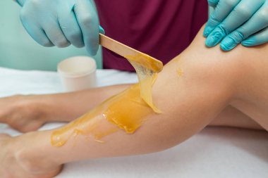 Woman undergoing leg hair removal procedure with sugaring paste in salon. Skin care, remove hair with sugar paste