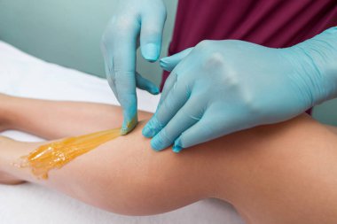 Woman undergoing leg hair removal procedure with sugaring paste in salon. Skin care, remove hair with sugar paste