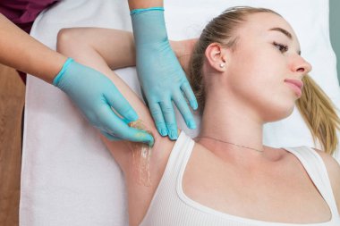 Depilation and epilation of the female armpit with liquid sugar paste. The beautician's hand applies wax paste to the armpit. The concept of smooth armpits