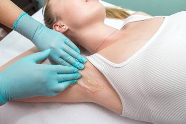 Depilation and epilation of the female armpit with liquid sugar paste. The beautician's hand applies wax paste to the armpit. The concept of smooth armpits