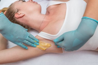Depilation and epilation of the female armpit with liquid sugar paste. The beautician's hand applies wax paste to the armpit. The concept of smooth armpits