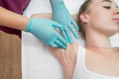Depilation and epilation of the female armpit with liquid sugar paste. The beautician's hand applies wax paste to the armpit. The concept of smooth armpits