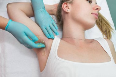 Depilation and epilation of the female armpit with liquid sugar paste. The beautician's hand applies wax paste to the armpit. The concept of smooth armpits