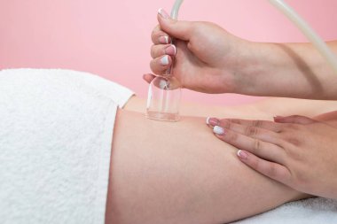 Hardware cosmetology. Vacuum massage procedure in a medical beauty center. Close-up of a young woman's anti-cellulite cupping therapy.