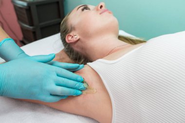 Depilation and epilation of the female armpit with liquid sugar paste. The beautician's hand applies wax paste to the armpit. The concept of smooth armpits