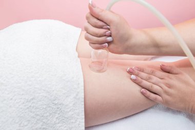 Hardware cosmetology. Vacuum massage procedure in a medical beauty center. Close-up of a young woman's anti-cellulite cupping therapy.
