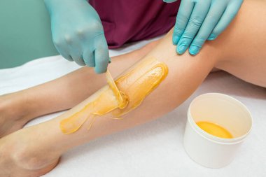 Woman undergoing leg hair removal procedure with sugaring paste in salon. Skin care, remove hair with sugar paste