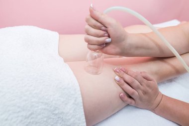 Hardware cosmetology. Vacuum massage procedure in a medical beauty center. Close-up of a young woman's anti-cellulite cupping therapy.
