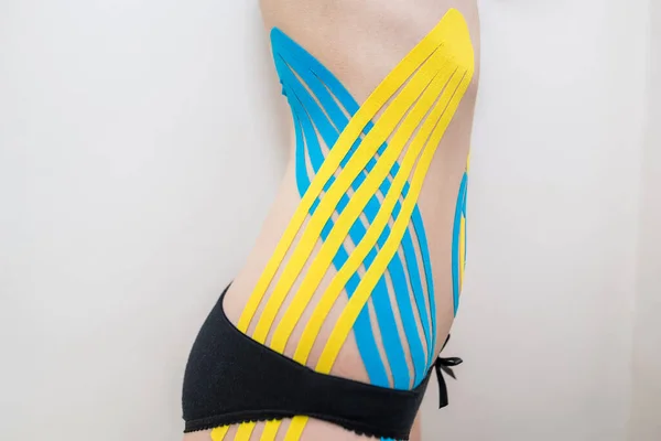 Kinesio Tape Zijkanten Van Buik Van Een Jong Meisje — Stockfoto