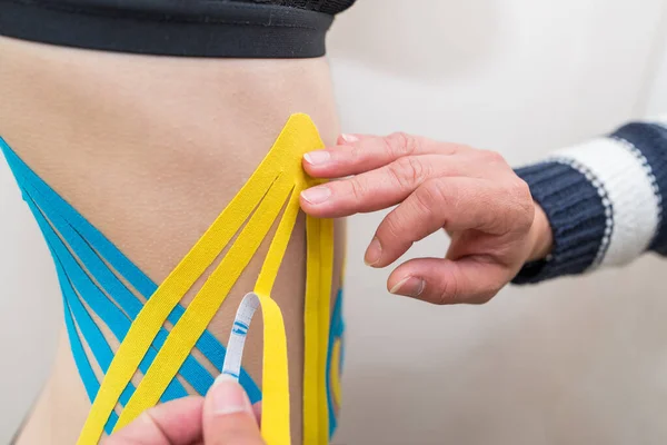 Fisioterapeuta Aplicando Cinta Adhesiva Elástica Terapéutica Lado Del Abdomen Una — Foto de Stock