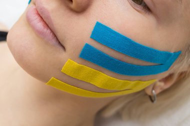 Yüz bandı, kırışıklık önleyici kozmetoloji bandıyla bir kızın yüzünün yakın çekimi. Yüzün estetik bandı. Kırışıklıkları azaltmak için yaşlanmayı önleyici bir yöntem.