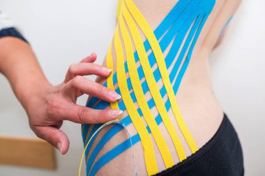 Fizyoterapist, genç yetişkin bir kadının muayenehanesindeki karın bölgesine yapışkan elastik tedavi bandı uyguluyor. Yaralı Rehabilitasyon ve Sağlık Hizmetleri