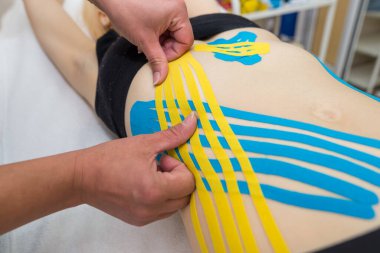 Kadın bir fizyoterapistin elleri, bir doktorun ofisindeki kanepede yatan genç, ince, atletik bir kadının karın kaslarına yapışkan elastik tedavi bandı uyguluyor. Yaralı Rehabilitasyon ve Sağlık Hizmetleri