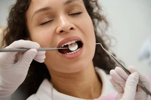 歯科医の予約で目を閉じて口を開いている女性のクローズアップ 滅菌ステンレス製の歯科用鏡で彼女の歯を調べる衛生士歯科医ながら 歯と口腔衛生の概念 — ストック写真