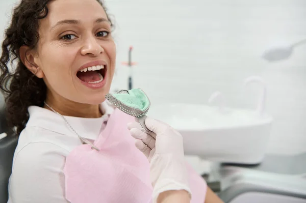 在牙科医生的近距离观察下 一名坐在牙医椅子上的女性病人的上下颚用硅胶材料造成的牙印已被去除 牙齿霉菌 高精度牙排的印迹 — 图库照片