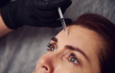 Kozmetik uzmanının bir kadının alnına iğne yaptığı yakın çekim. Genç bir kadın güzellik salonunda yüz aşısı yaptırıyor. Yaşlanma, gençleşme ve hidrasyon prosedürleriyle yüzleş. Estetik kozmetoloji