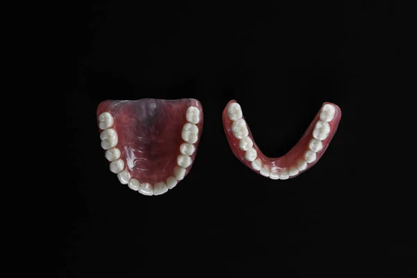 顎の完全な取り外し可能なプラスチック製の入れ歯 黒の背景に入れ歯がセットされています アクリル製の入れ歯2つ 上顎と下顎に偽の歯がある 入れ歯や偽の歯 クローズアップ スペースのコピー — ストック写真