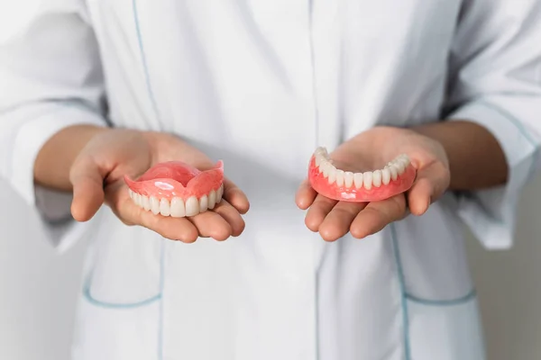 Dentista Tem Dentaduras Nas Mãos Prótese Dentária Nas Mãos Médico — Fotografia de Stock