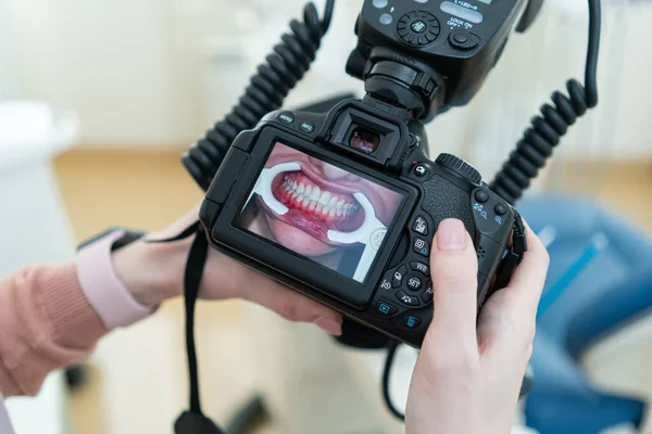 Fotógrafo Fotografar Dentes Cliente Odontologia — Fotografia de Stock