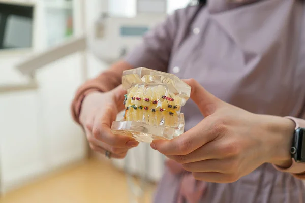 Зубные Скобки Заготовке Стоматологии — стоковое фото