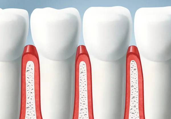 Tanden en tandvlees — Stockfoto