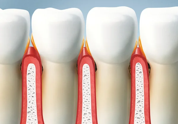 Dientes y encías —  Fotos de Stock