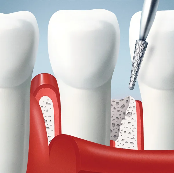 Denti e gengive — Foto Stock