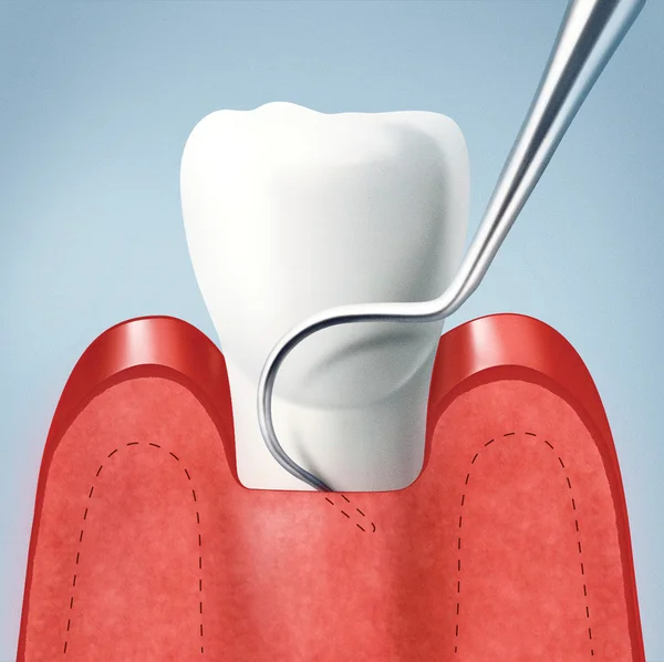 Denti e gengive — Foto Stock